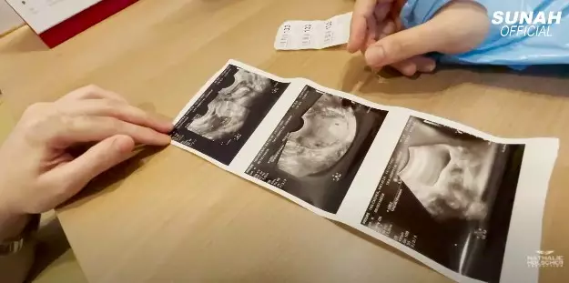 Momen Nathalie Holscher cek kandungan © YouTube Momen Nathalie Holscher cek kandungan © YouTube