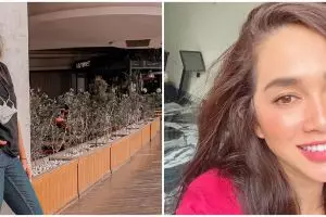 Potret lawas Ussy sebelum operasi tahi lalat ini curi perhatian