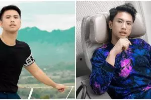 Usai operasi hidung, begini 9 penampilan terbaru Ricky Cuaca