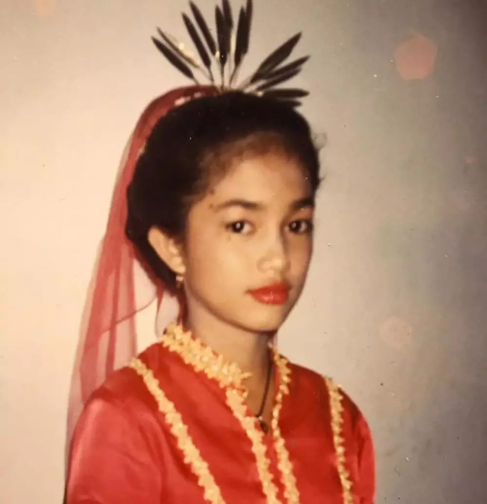 potret lawas ussy sebelum operasi tahi lalat © berbagai sumber