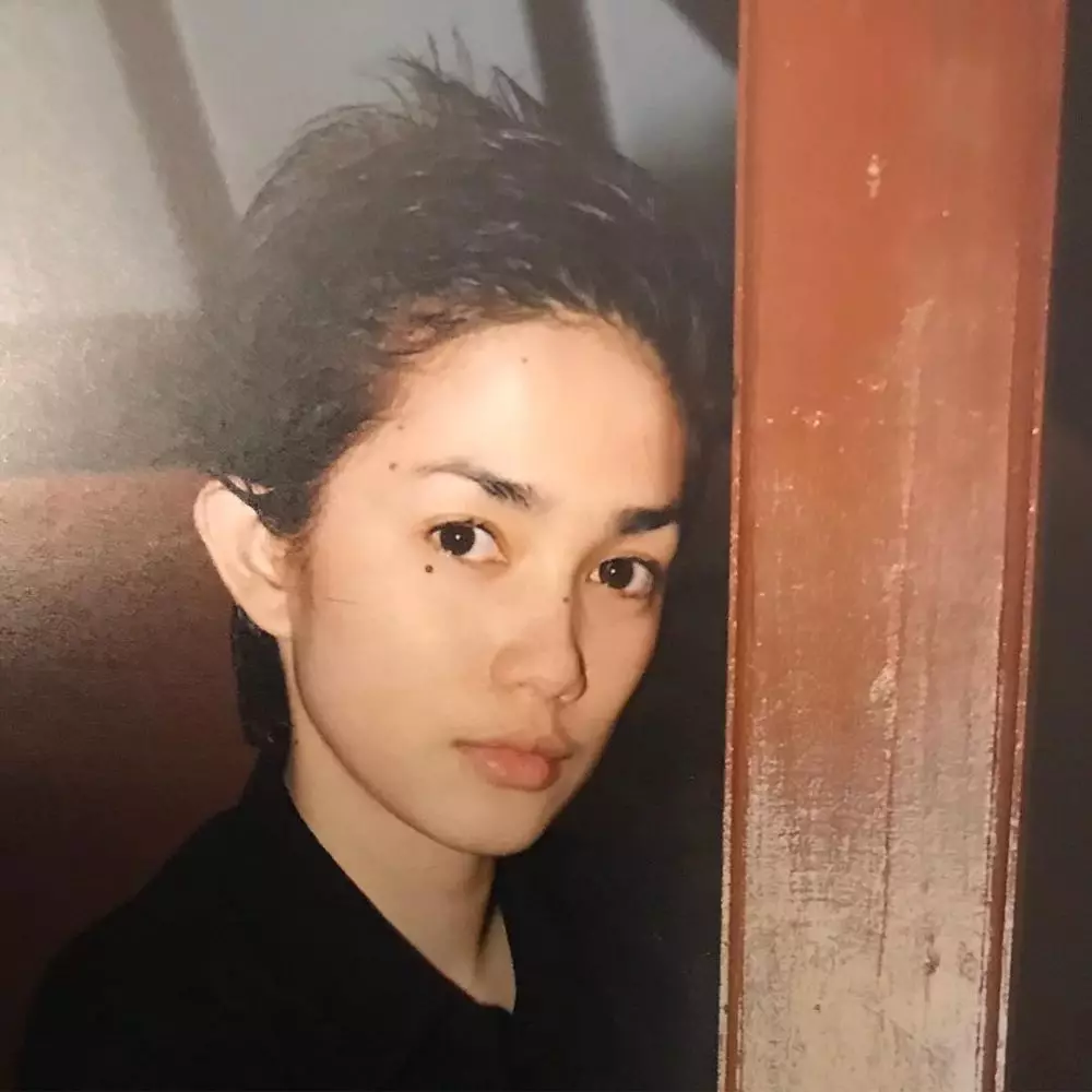 potret lawas ussy sebelum operasi tahi lalat © berbagai sumber