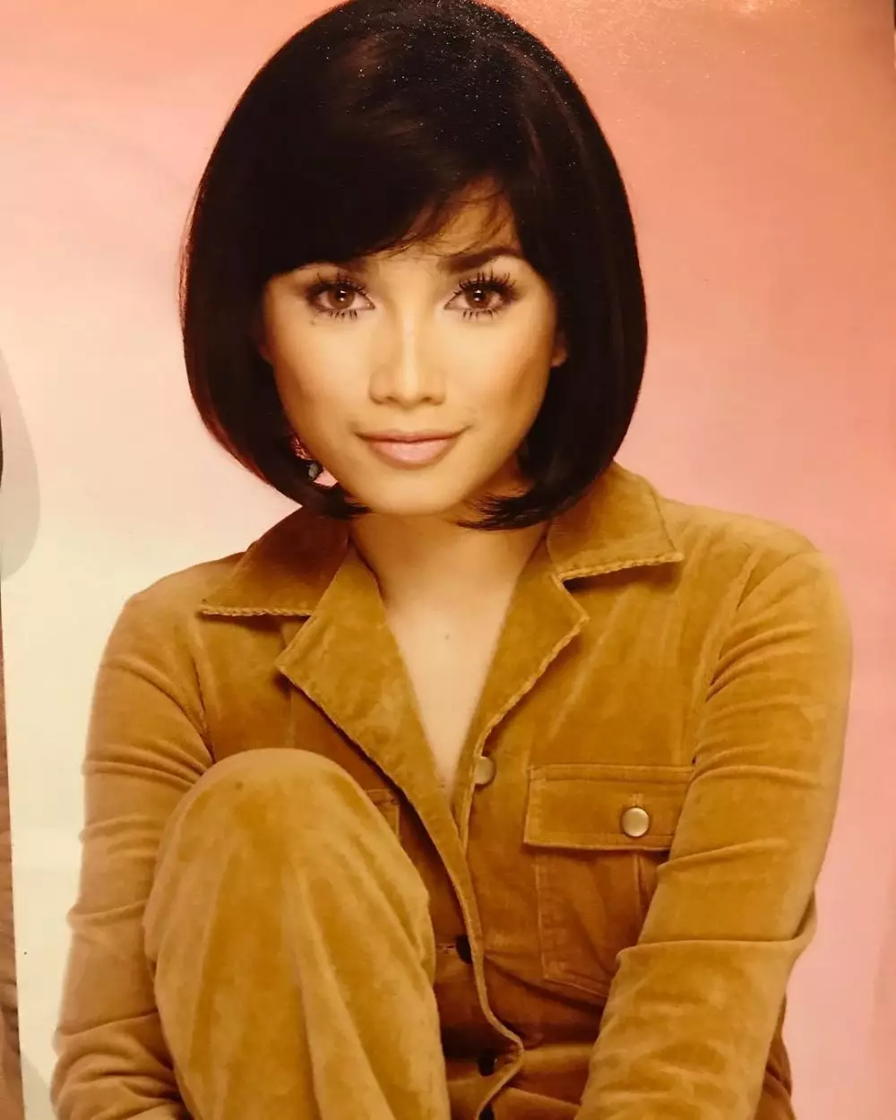 potret lawas ussy sebelum operasi tahi lalat © berbagai sumber