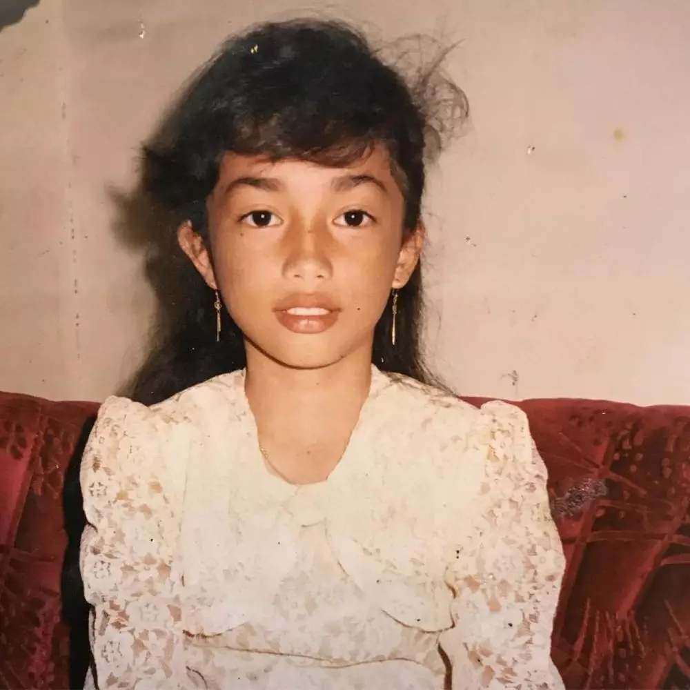 potret lawas ussy sebelum operasi tahi lalat © berbagai sumber