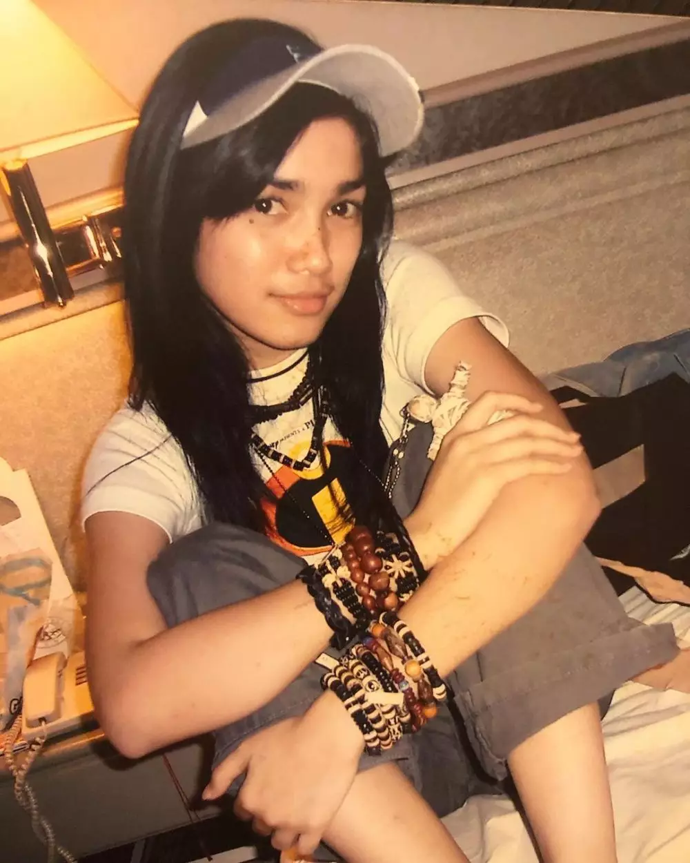 potret lawas ussy sebelum operasi tahi lalat © berbagai sumber