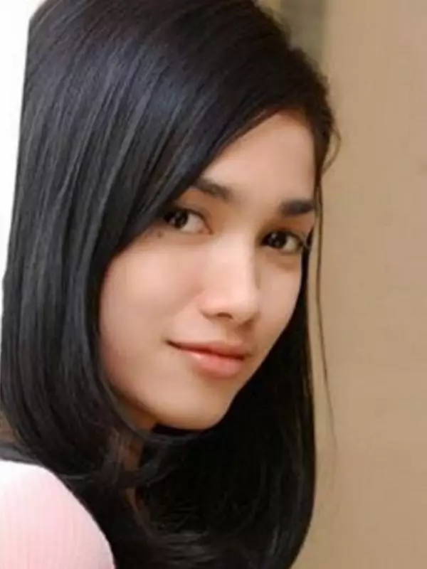 potret lawas ussy sebelum operasi tahi lalat © berbagai sumber