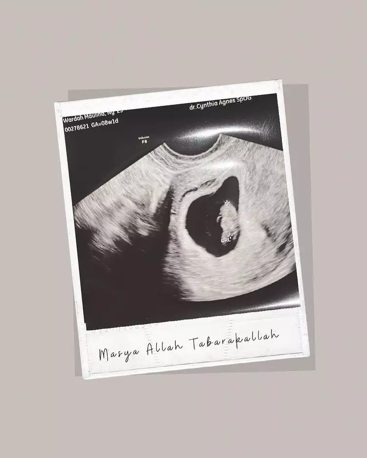 Natta Reza dan Wardah Maulina umumkan kehamilan © 2021 brilio.net