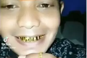 pamer gigi emas Berbagai sumber