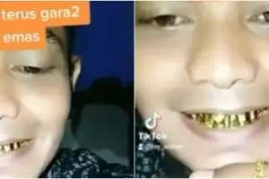 Viral cowok pamer perhiasan hingga gigi emas, gusi sampai bengkak