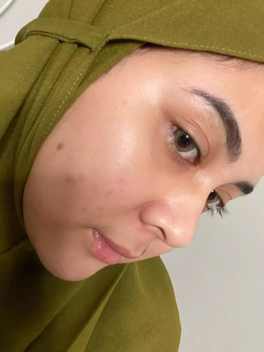 pesinetron tak segan unggah foto berjerawat © berbagai sumber