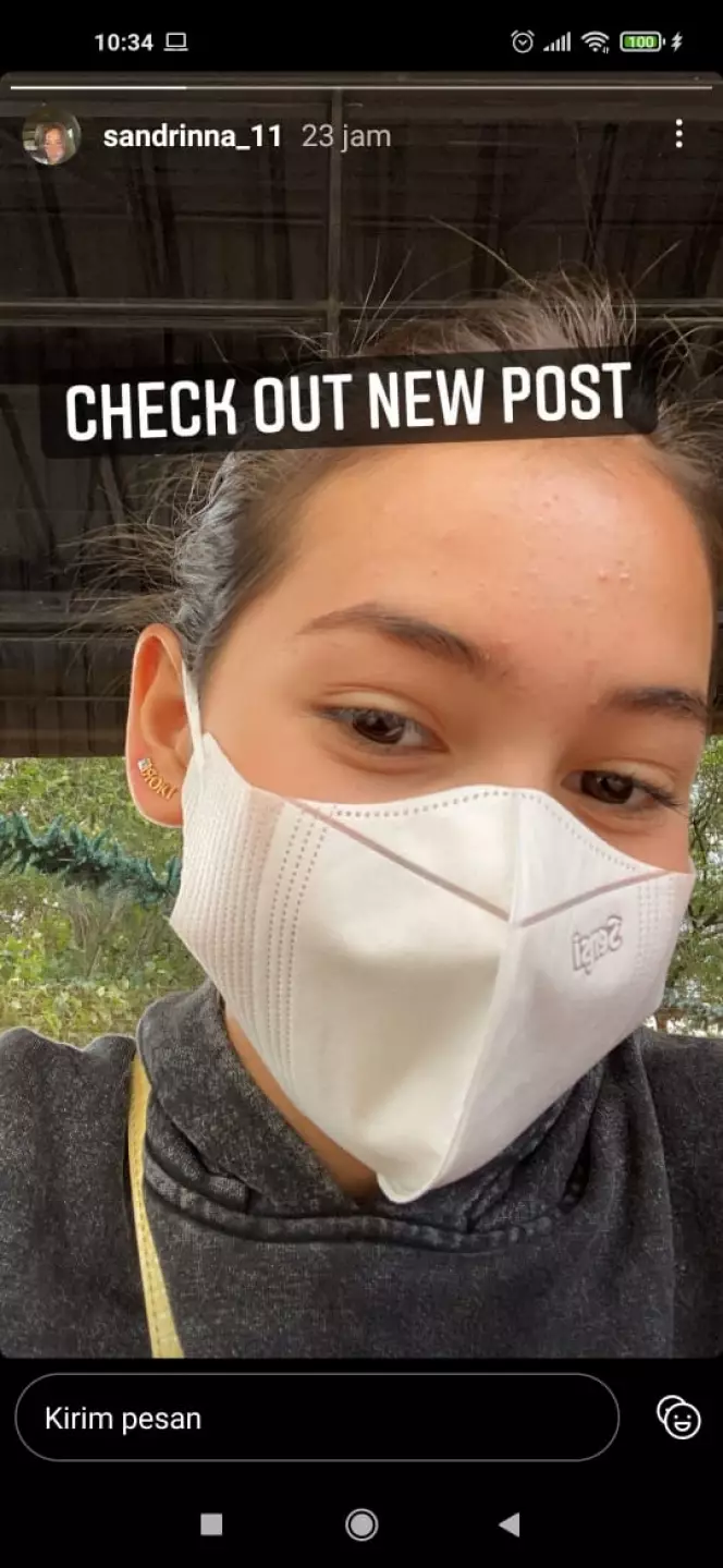 pesinetron tak segan unggah foto berjerawat © berbagai sumber