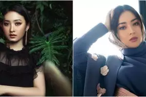 Percaya diri, 8 pesinetron ini tak segan unggah foto wajah berjerawat