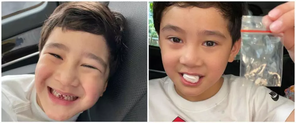 momen rafathar cabut gigi © 2021 brilio.net