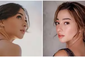7 Potret perubahan wajah Nikita Willy saat berjerawat