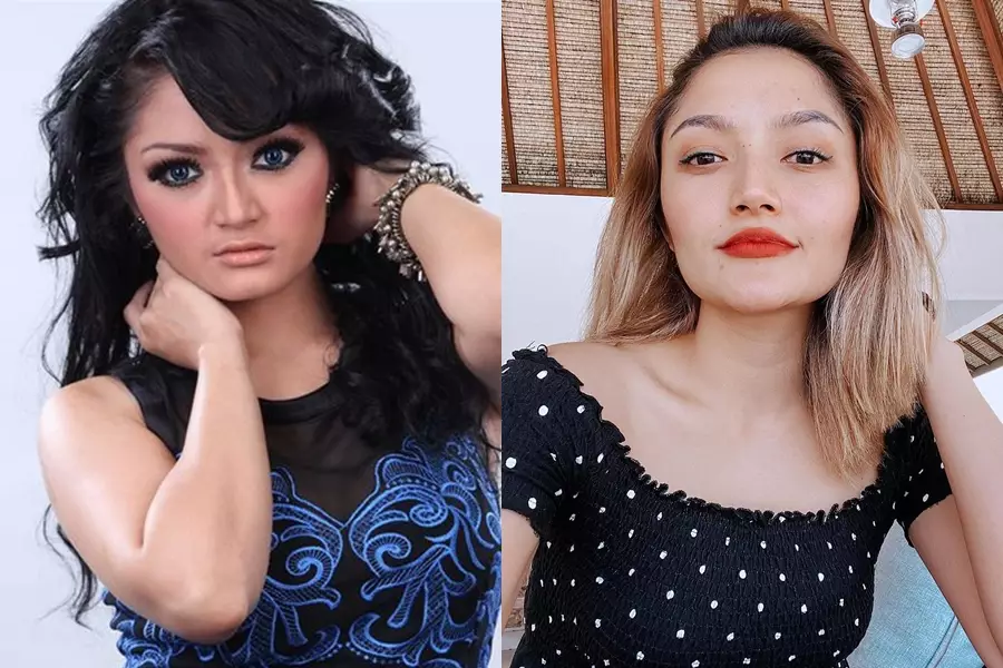 Beda penampilan seleb sebelum dan sesudah filler © berbagai sumber Beda penampilan seleb sebelum dan sesudah filler © berbagai sumber