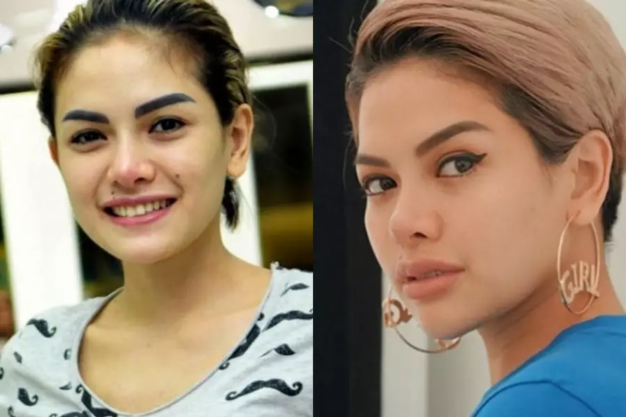 Beda penampilan seleb sebelum dan sesudah filler © berbagai sumber Beda penampilan seleb sebelum dan sesudah filler © berbagai sumber