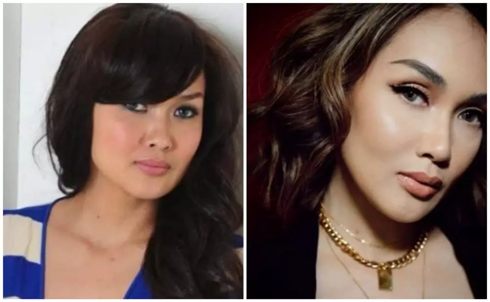 Beda penampilan seleb sebelum dan sesudah filler © berbagai sumber Beda penampilan seleb sebelum dan sesudah filler © berbagai sumber