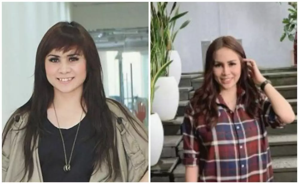 Beda penampilan seleb sebelum dan sesudah filler © berbagai sumber Beda penampilan seleb sebelum dan sesudah filler © berbagai sumber