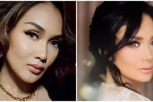 Beda penampilan 11 seleb sebelum & sesudah filler, ada yang awet muda