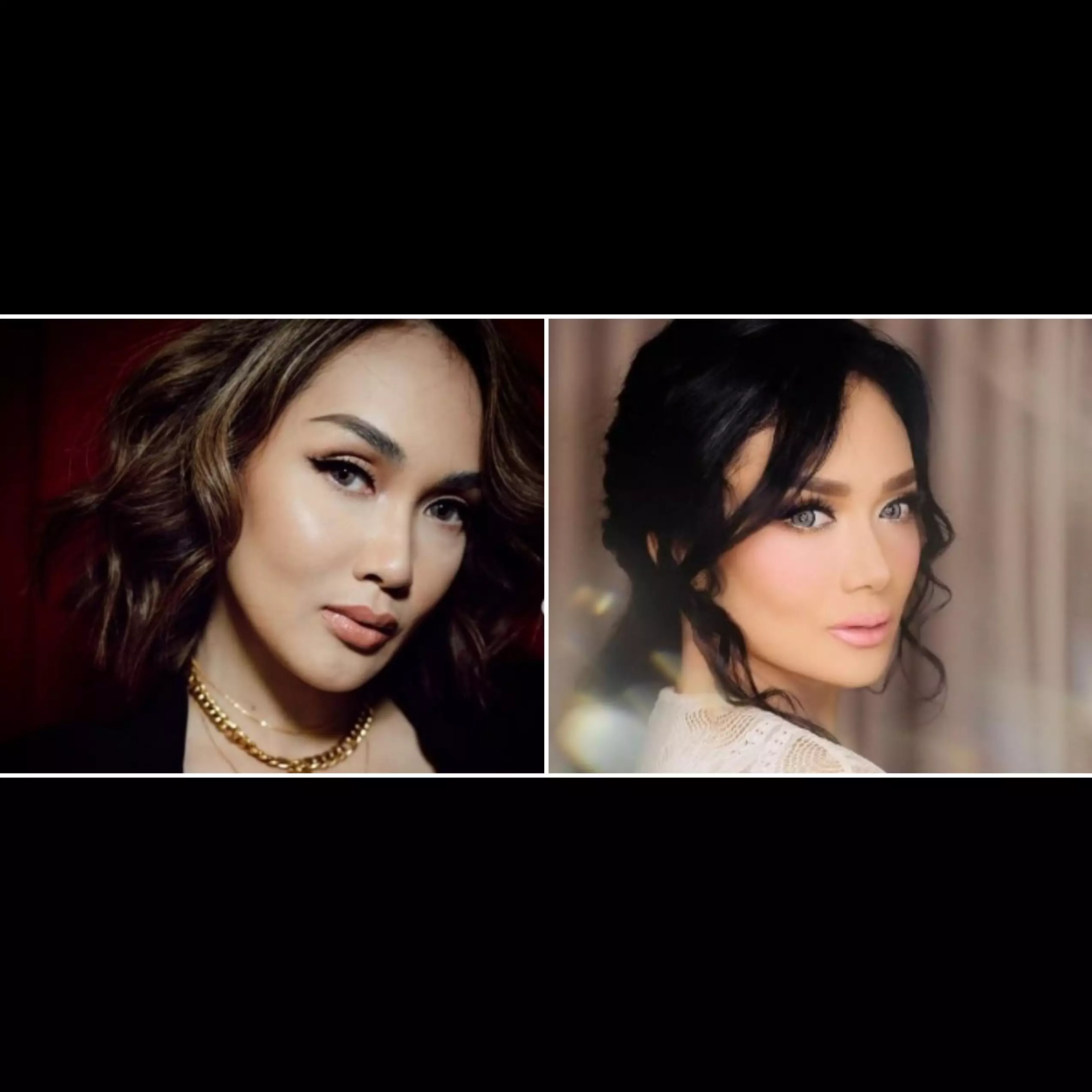 Beda penampilan 11 seleb sebelum &amp; sesudah filler, ada yang awet muda