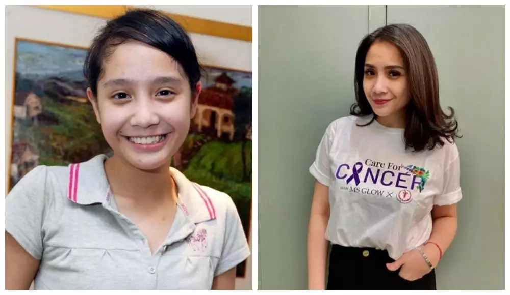 Potret seleb cantik saat remaja vs sudah punya anak © berbagai sumber