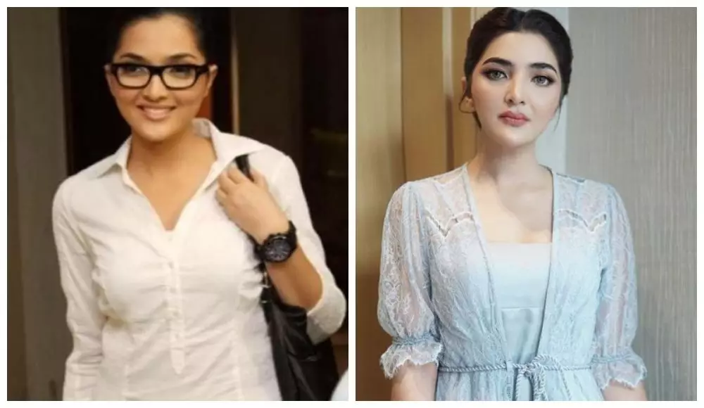 Potret seleb cantik saat remaja vs sudah punya anak © berbagai sumber