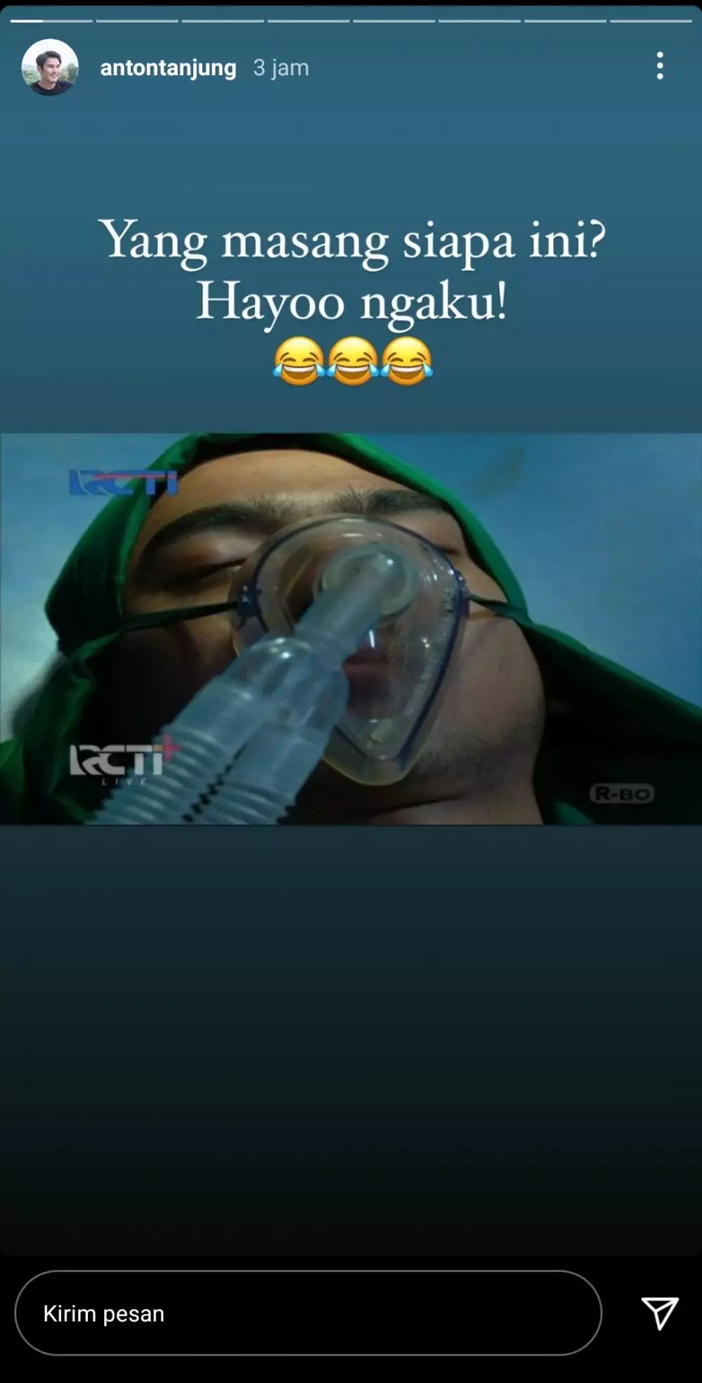 reaksi Amanda Manopo soal adegan medis © 2021 brilio.net