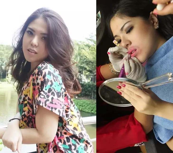 potret seleb sebelum dan setelah sulam bibir © 2021 brilio.net