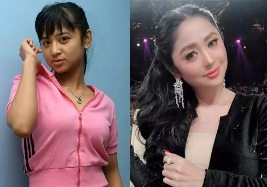 potret seleb sebelum dan setelah sulam bibir © 2021 brilio.net