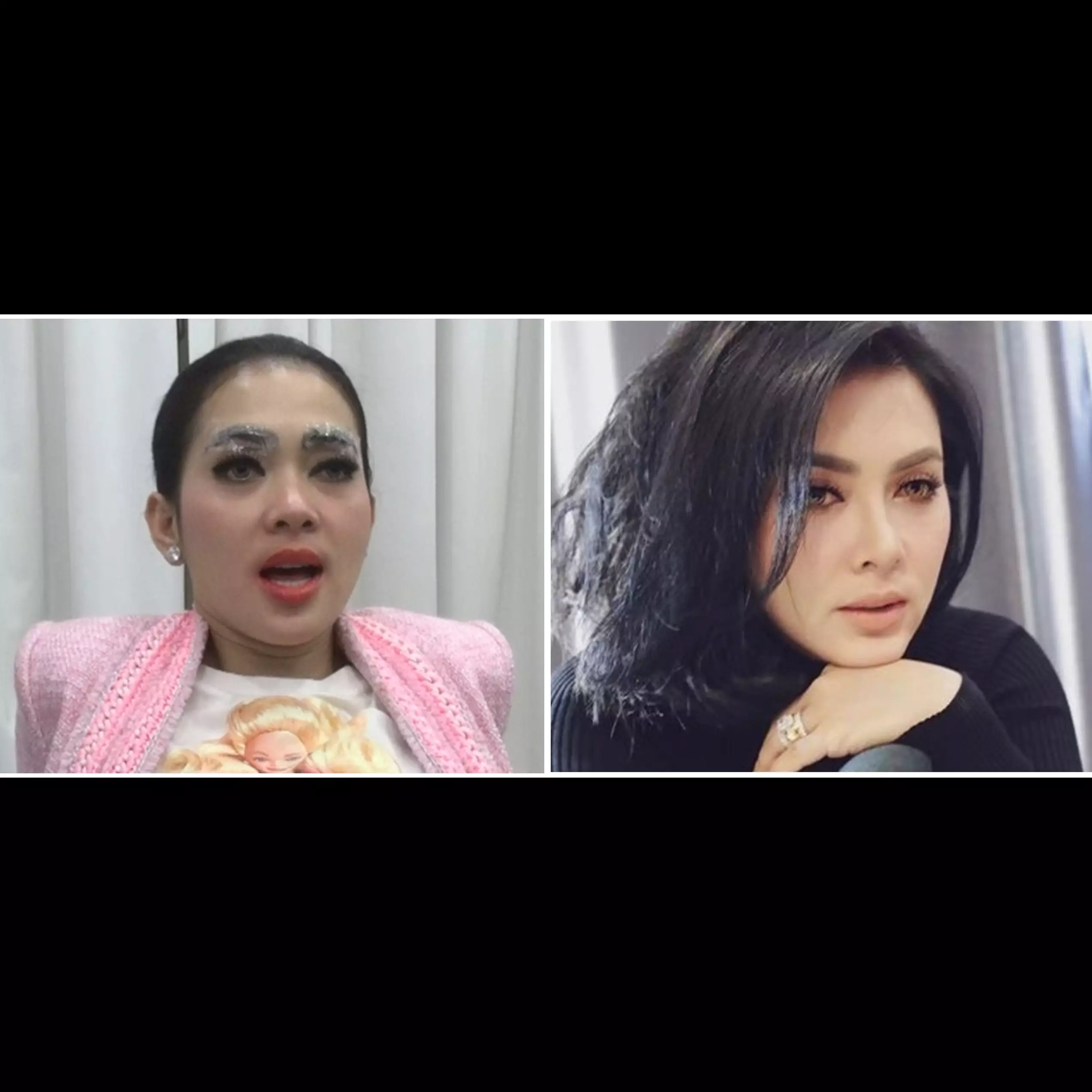 Penampilan 6 seleb sebelum &amp; sesudah sulam bibir, Sarwendah disorot