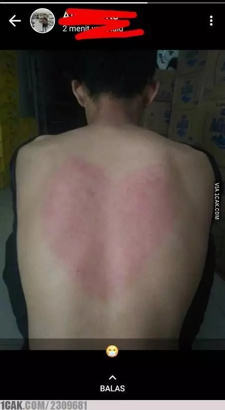 hasil orang kerokan © 2021 berbagai sumber