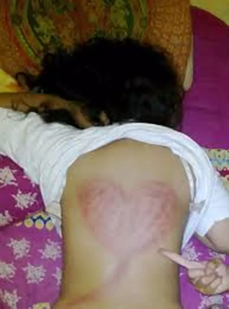 hasil orang kerokan © 2021 berbagai sumber