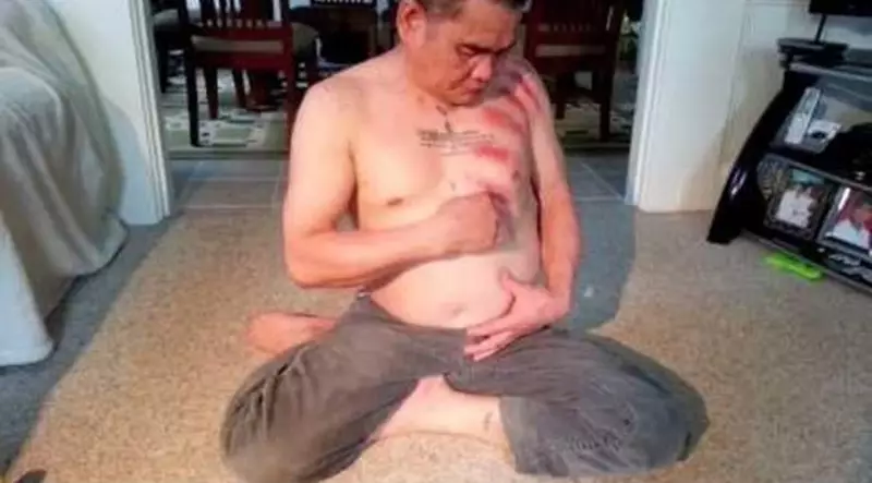 hasil orang kerokan © 2021 berbagai sumber