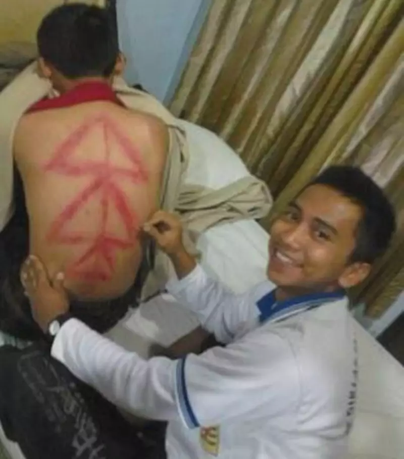 hasil orang kerokan © 2021 berbagai sumber