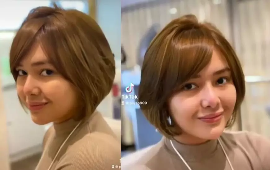 perubahan wajah Amanda Manopo usai suntik wajah © 2021 brilio.net