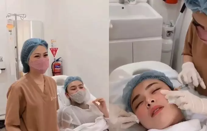 perubahan wajah Amanda Manopo usai suntik wajah © 2021 brilio.net