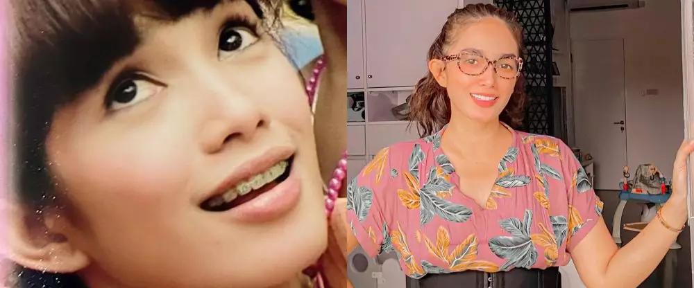 potret dulu dan kini seleb usai pakai behel © berbagai sumber potret dulu dan kini seleb usai pakai behel © berbagai sumber