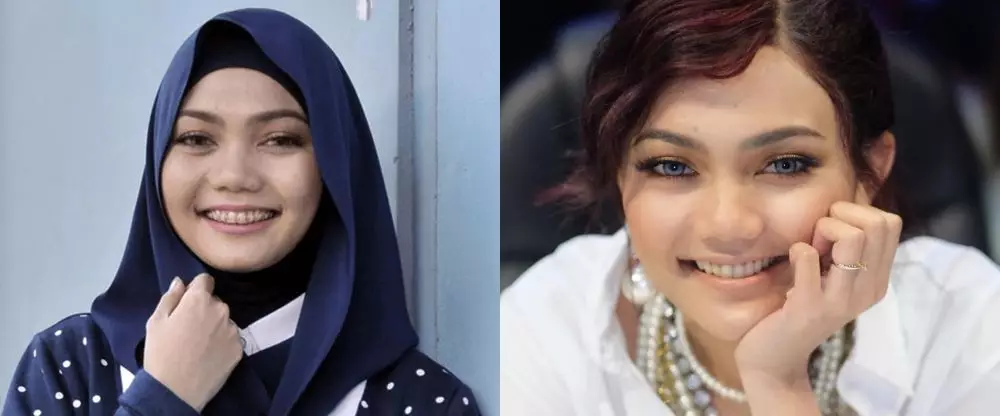 potret dulu dan kini seleb usai pakai behel © berbagai sumber potret dulu dan kini seleb usai pakai behel © berbagai sumber