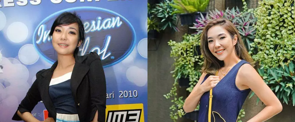 potret dulu dan kini seleb usai pakai behel © berbagai sumber potret dulu dan kini seleb usai pakai behel © berbagai sumber