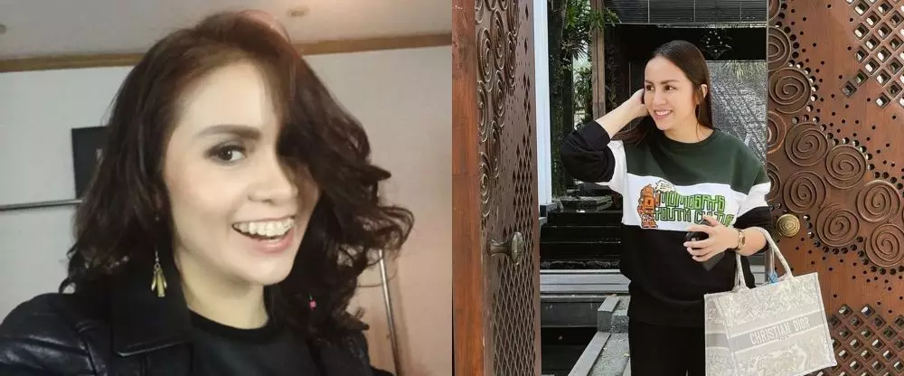 potret dulu dan kini seleb usai pakai behel © berbagai sumber potret dulu dan kini seleb usai pakai behel © berbagai sumber