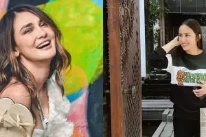 Potret dulu dan kini 8 seleb usai pakai behel, dipuji makin cantik