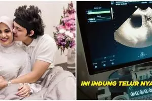 10 Momen Aurel Hermansyah cek kandungan usai umumkan kehamilan