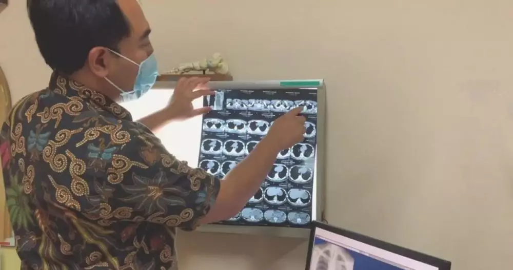 suami Tasya Kamila kanker getah bening © 2021 brilio.net