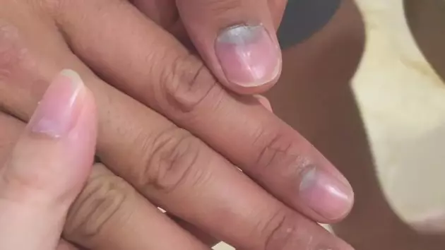 suami Tasya Kamila kanker getah bening © 2021 brilio.net