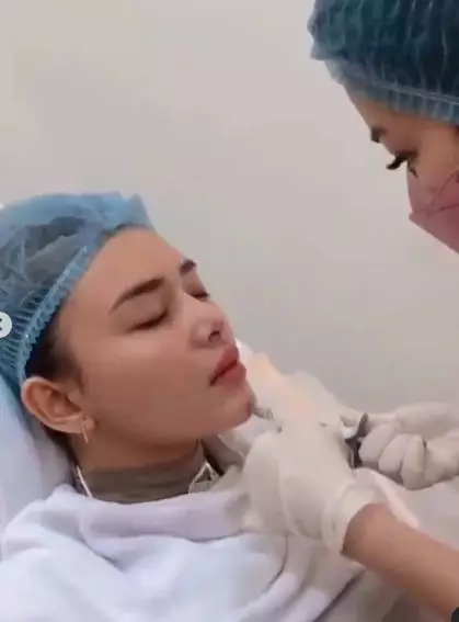 Menawan di usia 21 tahun © Instagram/@nurmala_suryani15