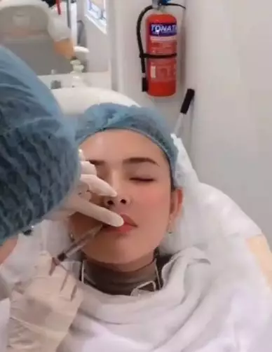 Menawan di usia 21 tahun © Instagram/@nurmala_suryani15