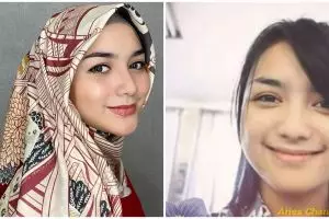 8 Potret Citra Kirana saat remaja, senyumannya khas banget