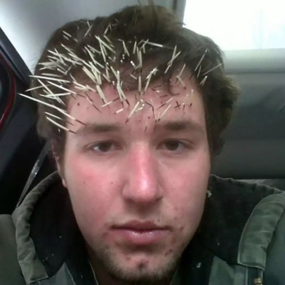 momen apes orang karena kurang hati hati Berbagai sumber momen apes orang karena kurang hati hati Berbagai sumber