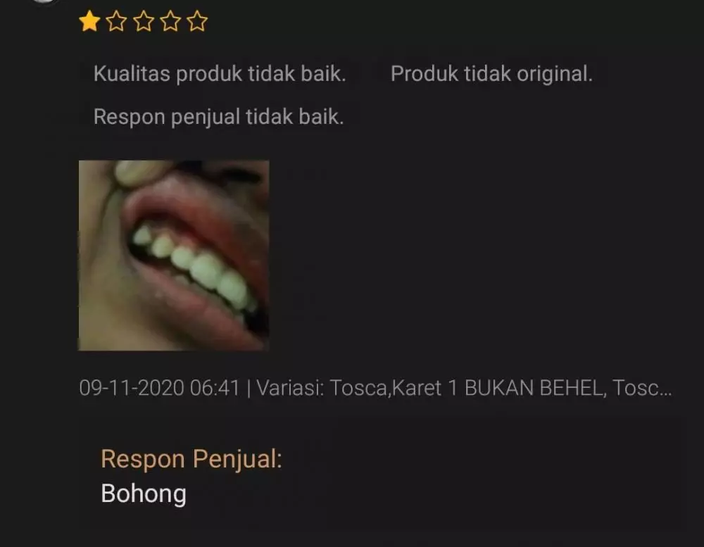 testimoni pembeli behel Berbagai sumber