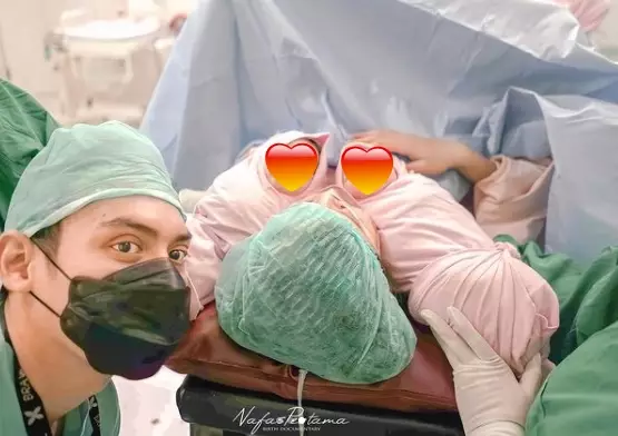 Potret perjalanan kehamilan Talita Bachtiar berbagai sumber