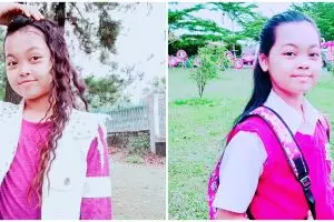 8 Cerita perjuangan Misca 'Mancung